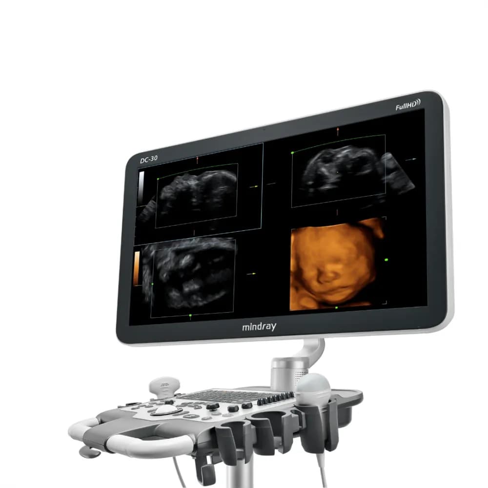 MINDRAY DC 30 Full HD — 3