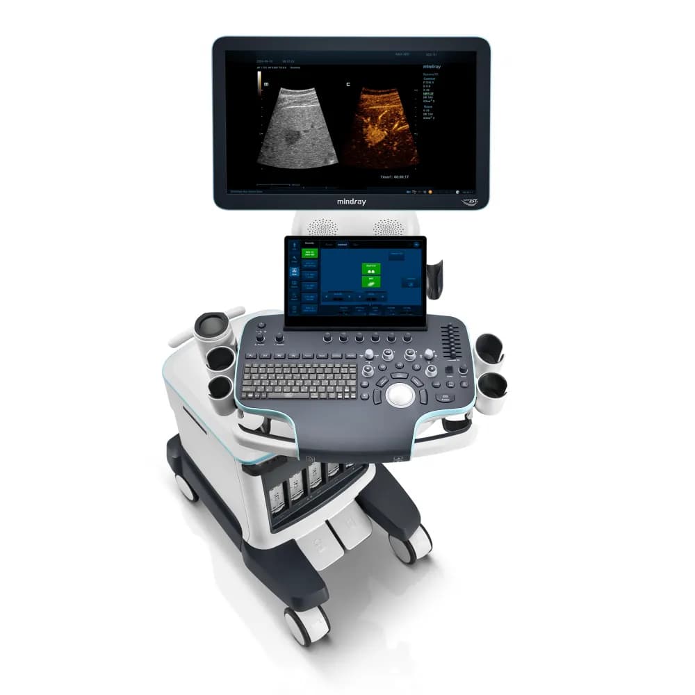 Mindray: Resona R9 — 2